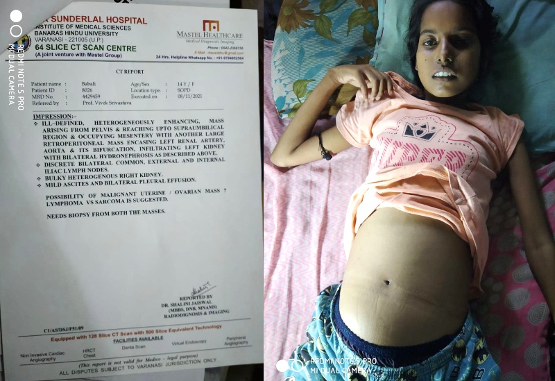 उतर प्रदेश का दुर्भाग्य कि मरीज को नहीं मिली सहायता, दूसरे राज्य के विधायक ने किया सहयोग